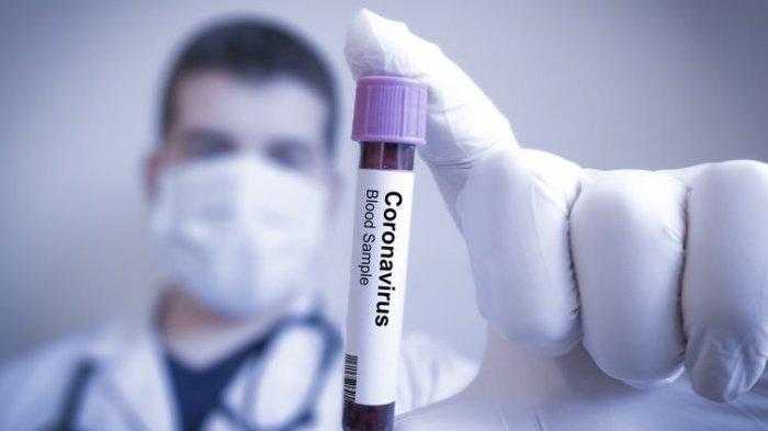 Ilmuwan Khawatir Kini Virus Corona Sudah Bermutasi, Penderitanya Makin Sulit Dideteksi.