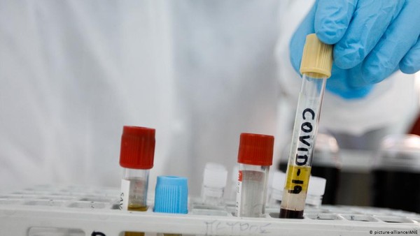 Total 9 vaksin Corona yang saat ini tengah diuji coba pada manusia. (Foto: DW News)